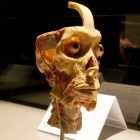 Body World (17)