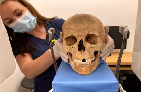 Katowiccy dentyści badają zęby tzw. wampirów z Gliwic
