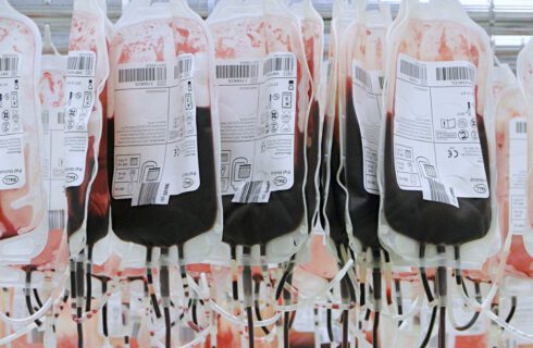 Za dużo krwi w Katowicach. Dawcy są proszeni o przełożenie wizyt